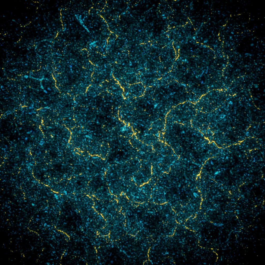 Day 1 — Laser Speckle Macro